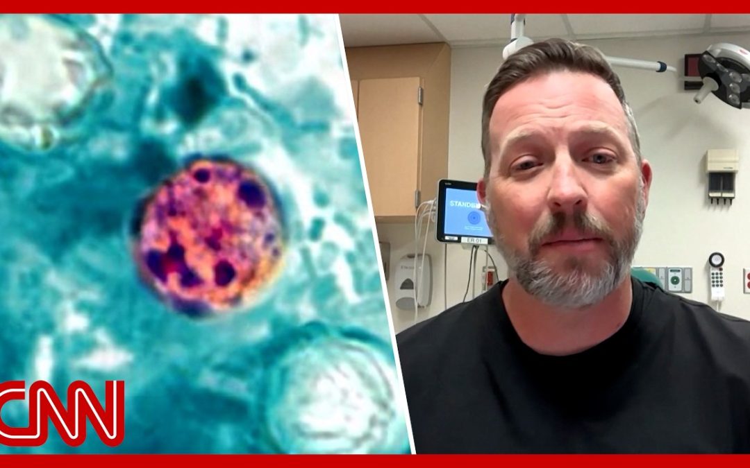 Diarrhea parasite: This food may be the source of Cyclospora