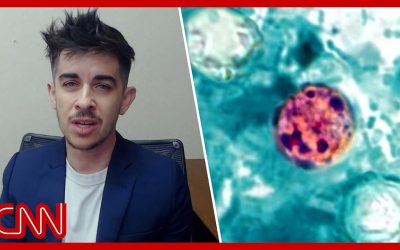 Diarrhea parasite cyclospora victim describes initial symptoms